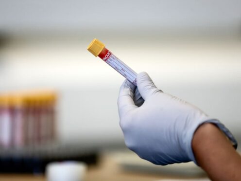 The study used a new technique that identified a set of six proteins that are highly accurate in pinpointing TB (Simon Dawson/PA)