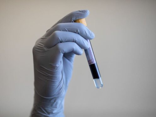 Blood test ‘could identify people at highest risk of dying from heart failure’ (Simon Dawson/PA)