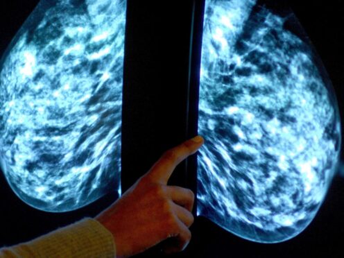Women at risk of breast cancer missed out on checks (Rui Vieira/PA)