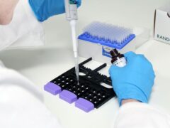 A biochip that helps identify people who are at risk of type 1 diabetes risk has been developed (University of Exeter/Randox)