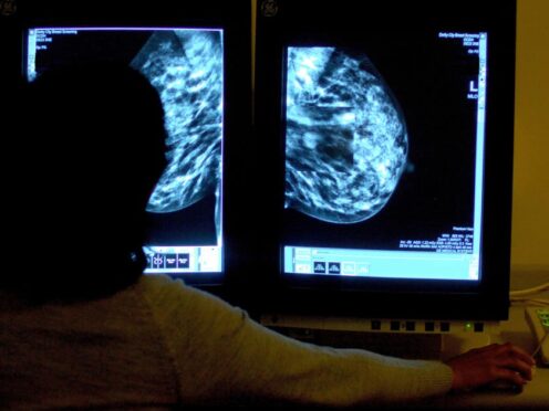 NHS Scotland’s performance against key cancer waiting times targets declined in the last three months of 2023, official figures showed. (Rui Vieira/PA)