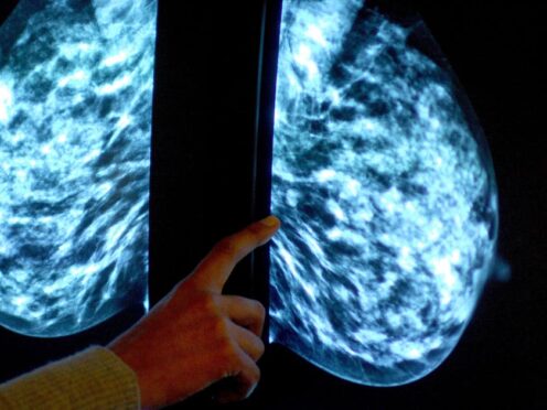 A new study has enabled scientists to study breast tissue in detail outside the body (Rui Vieira/PA)