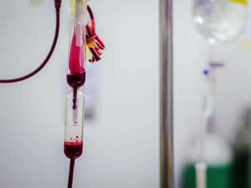 Anyone who had a blood transfusion before 1991 should be checked for hepatitis C, a charity has said (Alamy/PA)