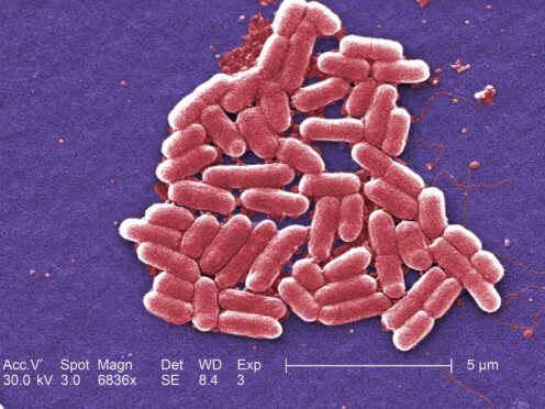 E. coli is a diverse group of bacteria that are normally harmless and live in the intestines of humans and animals (Centres for Disease Control and Prevention/PA)