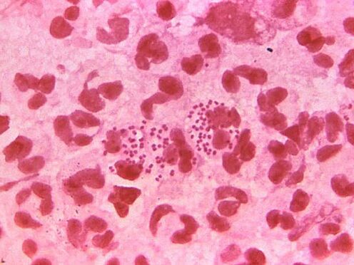 Levels of gonorrhoea in England are at the highest level since records began in 1918 (PA/CDC)