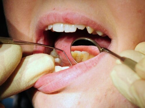 Labour wants to clear a dental treatment backlog (PA)