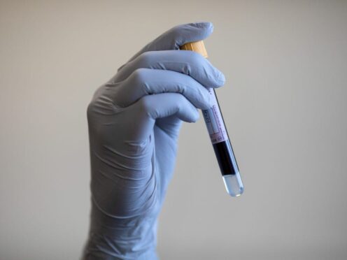 A new type of blood test can predict if breast cancer will come back years before it shows up on scans (Simon Dawson/PA)