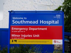 Southmead Hospital in Bristol where the Princess Royal is being treated after she ‘sustained minor injuries and concussion’ following an incident on the Gatcombe Park estate on Sunday evening (Ben Birchall/PA)