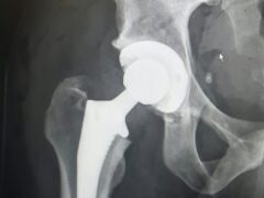 The medical equipment firm makes knee and hip replacements (Stuart Johnson/University of Bristol/PA)