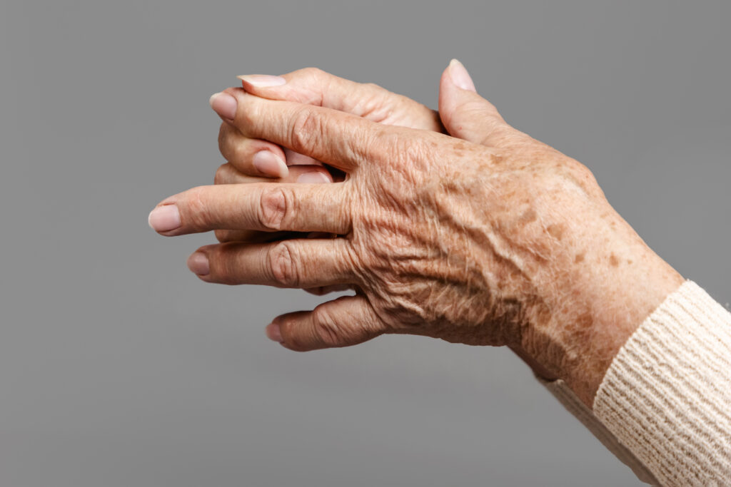 A senior woman massages her fingers, experiencing pain in the joints. Gray background, hands close-up. The concept of rheumatism and arthritis.;
